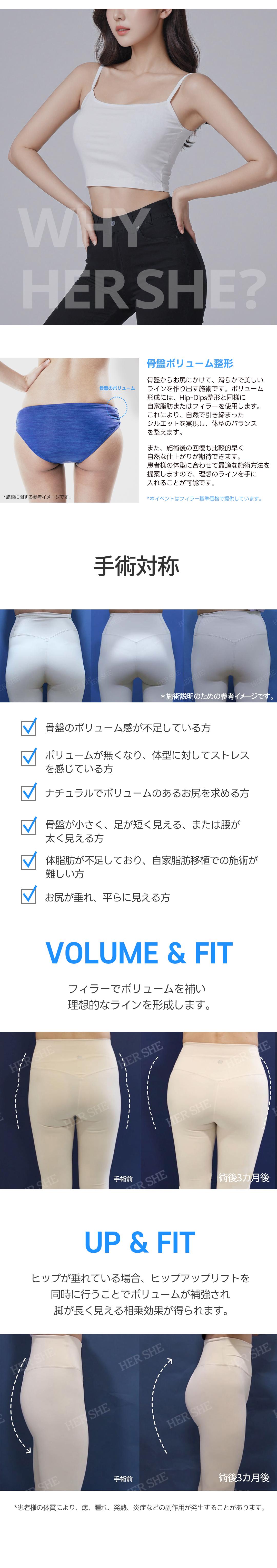 Thủ thuật filler xương chậu hướng đến đường cong cơ thể lý tưởng｜Phẫu thuật Thẩm mỹ HERSHE 30 năm thành tích｜Cheongdam