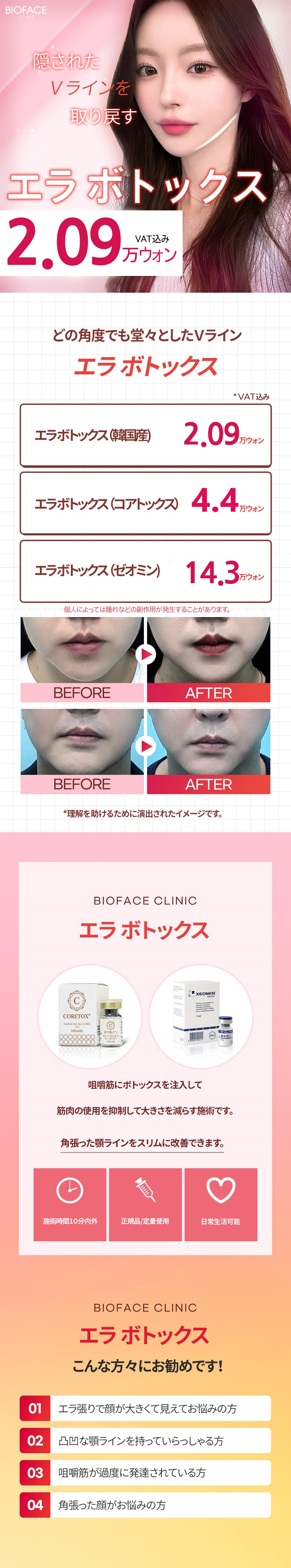 Tiêm Botox hàm làm thon đường viền mặt｜Có thể chọn Hàn Quốc・Coretox・Xeomin｜Phòng khám Bio Face Gangnam Seoul