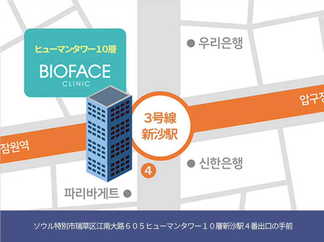 Filler mũi Phòng khám Bio Face Gangnam Seoul｜Thủ thuật thẩm mỹ Hàn Quốc chỉnh sống mũi không rạch【Ngay ga Sinsa】