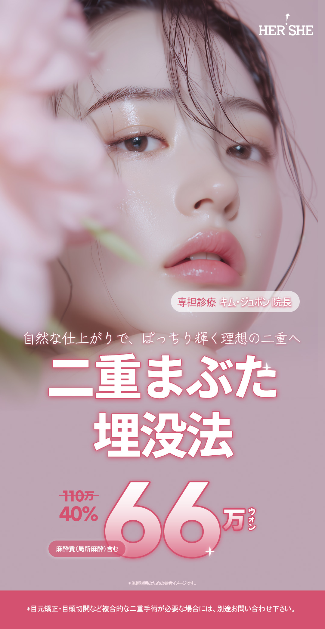 Tạo mí đôi bấm mí | Hướng tới mí đôi tròn xoe tự nhiên | Phòng khám HERSHE Thẩm mỹ (ga Cheongdam)