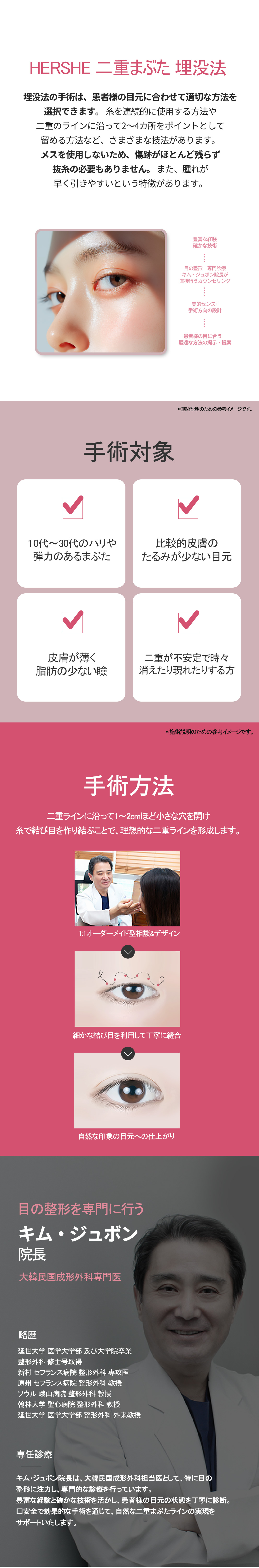 Tạo mí đôi bấm mí | Hướng tới mí đôi tròn xoe tự nhiên | Phòng khám HERSHE Thẩm mỹ (ga Cheongdam)