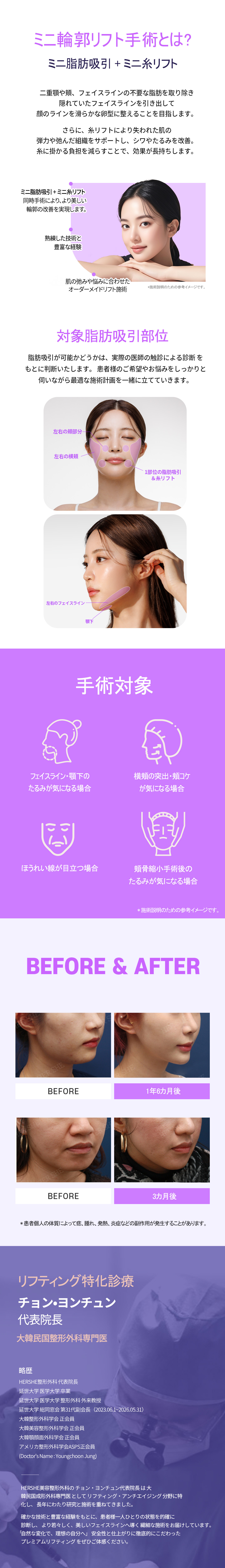 Mini Contour Lift tại Cheongdam Hàn Quốc | Hút mỡ + chỉ nâng cải thiện đường viền | Thẩm mỹ viện HERSHE