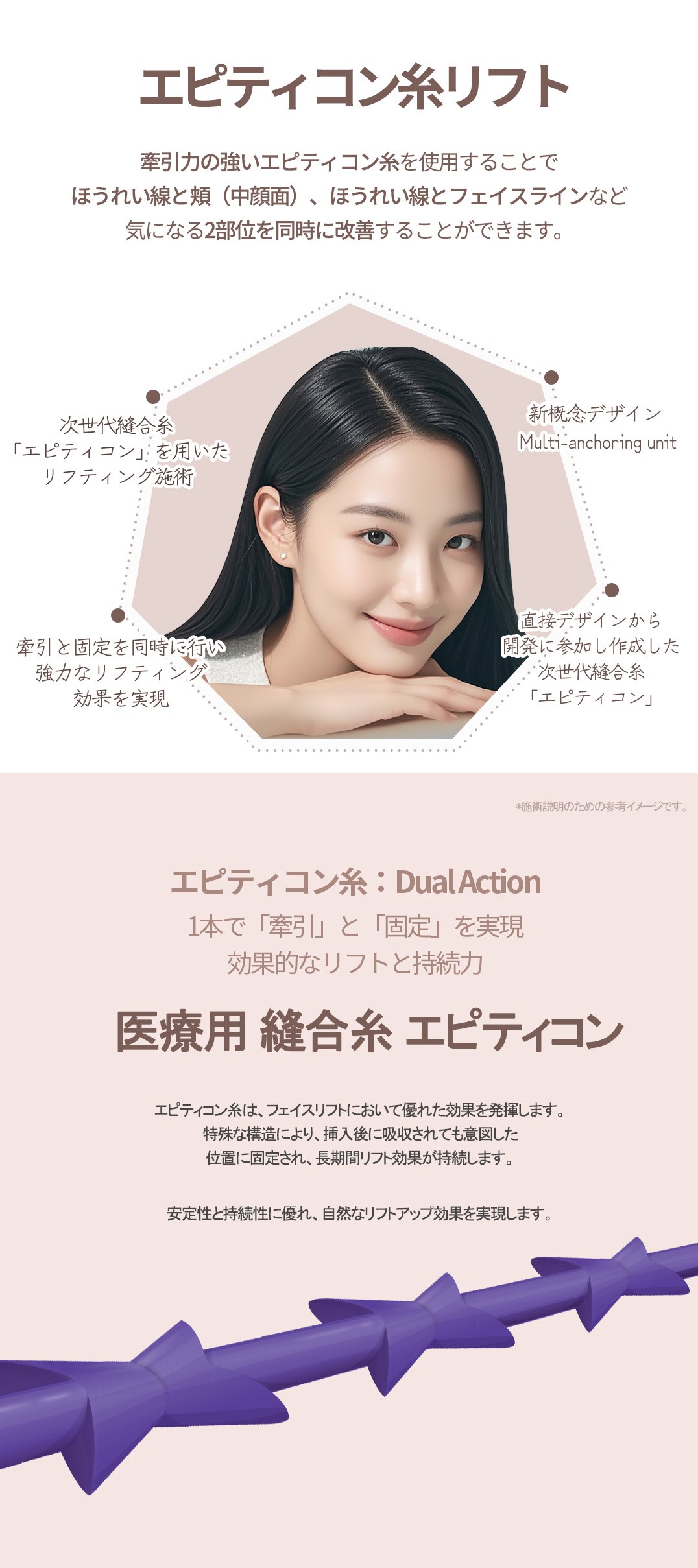 Chỉ nâng Epiticon | Liệu trình nâng mid-face và mặt nhỏ bởi bác sĩ phát triển | HERSHE Thẩm mỹ Ngoại khoa Seoul Cheongdam