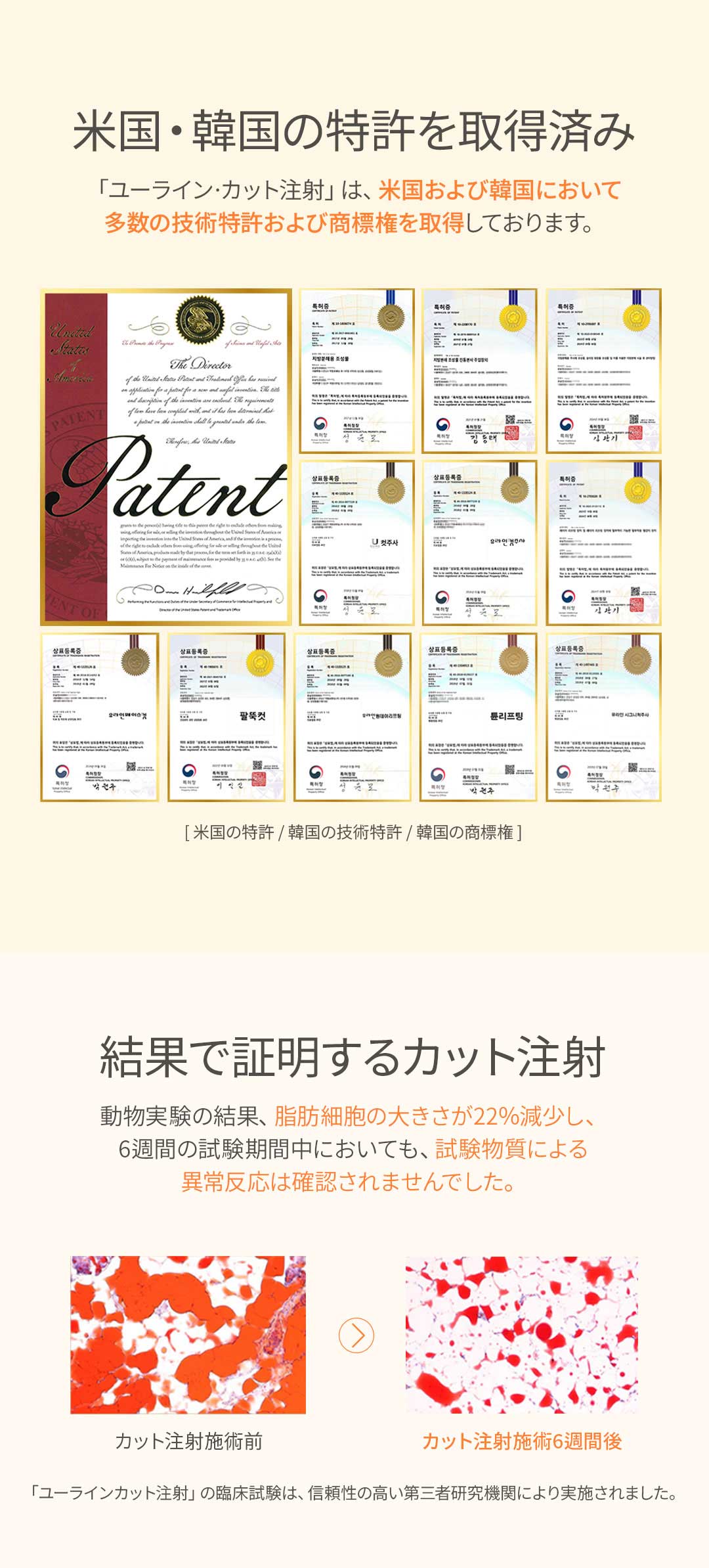 Titanium Lift, Tune Face, Tiêm tan mỡ Hàn Quốc | Chăm sóc nâng kết hợp sóng cao tần x siêu âm | Uline Clinic