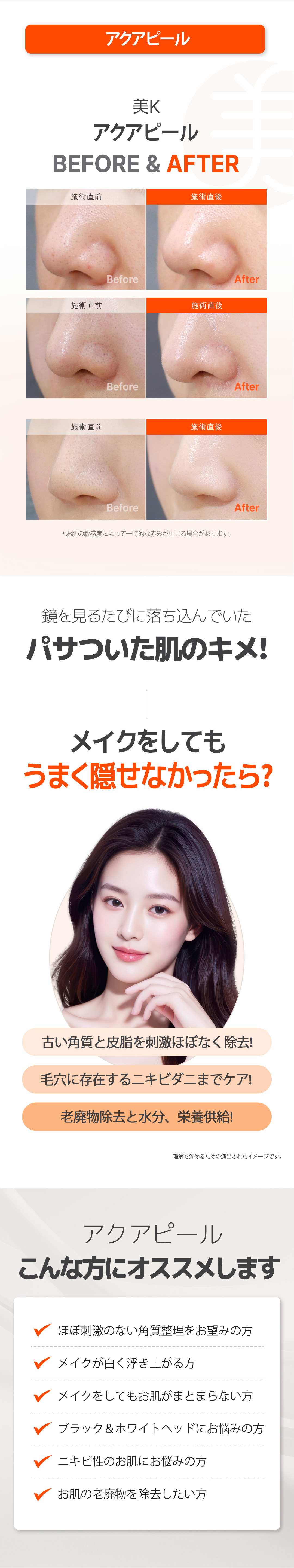 Chăm sóc lỗ chân lông Aqua Peel | Loại bỏ tế bào chết, bã nhờn, demodex theo 3 bước | Phòng khám MiK (kết nối trực tiếp ga Gangnam)