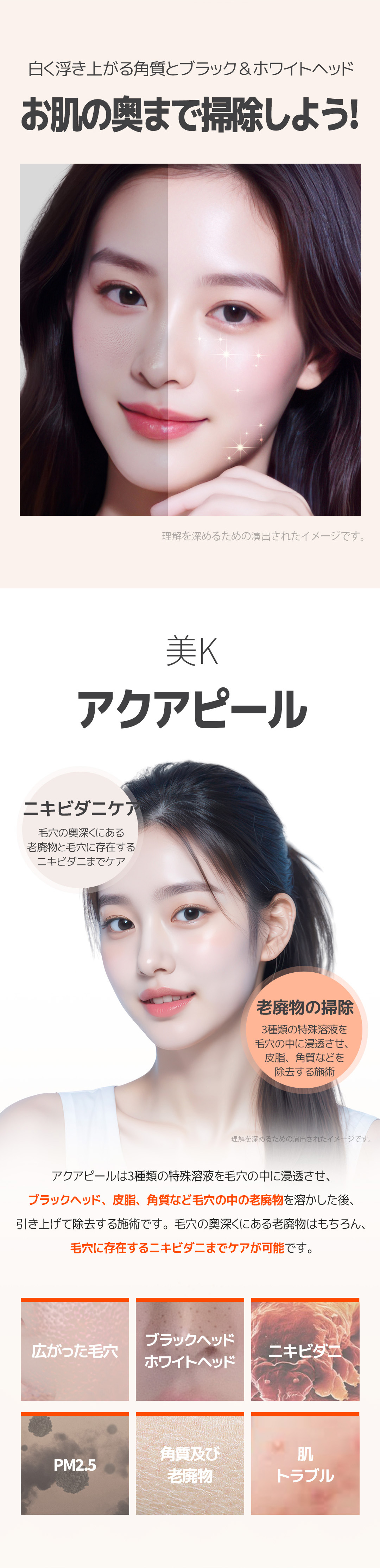 Chăm sóc lỗ chân lông Aqua Peel | Loại bỏ tế bào chết, bã nhờn, demodex theo 3 bước | Phòng khám MiK (kết nối trực tiếp ga Gangnam)