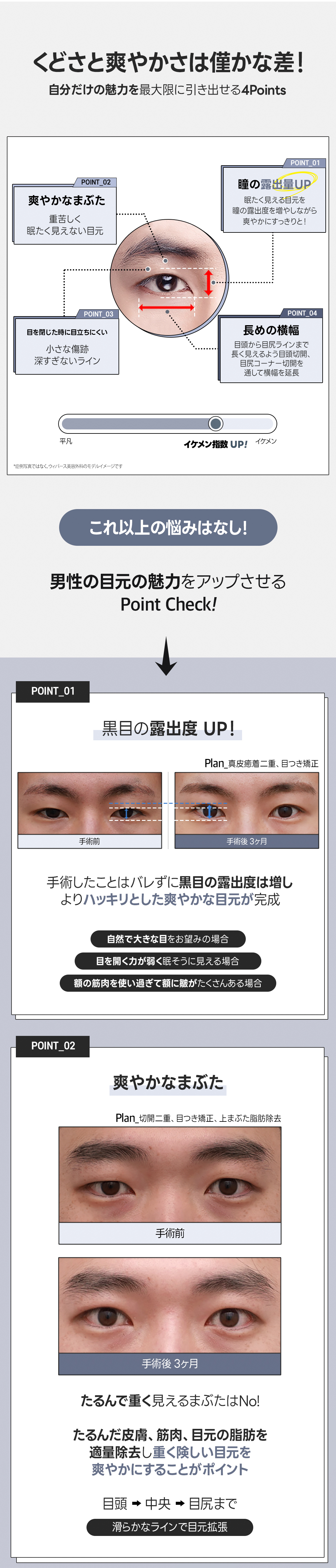 Phẫu thuật mí đôi nam Hàn Quốc | Hướng tới ấn tượng tươi mát với đôi mắt tự nhiên | Phòng khám Weavers Thẩm mỹ