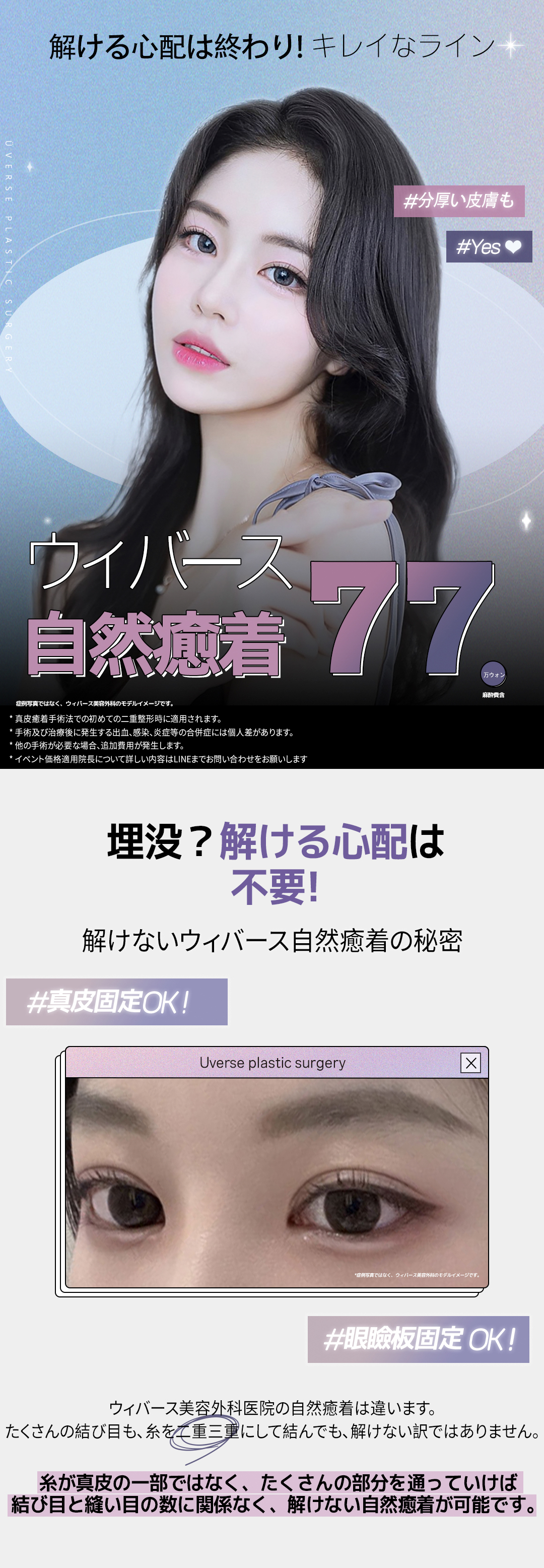 Weavers Thẩm mỹ Seoul Gangnam｜Hướng đến đường viền khó tuột với chỉnh hình mí đôi bám dính tự nhiên｜Phương pháp cố định chân bì