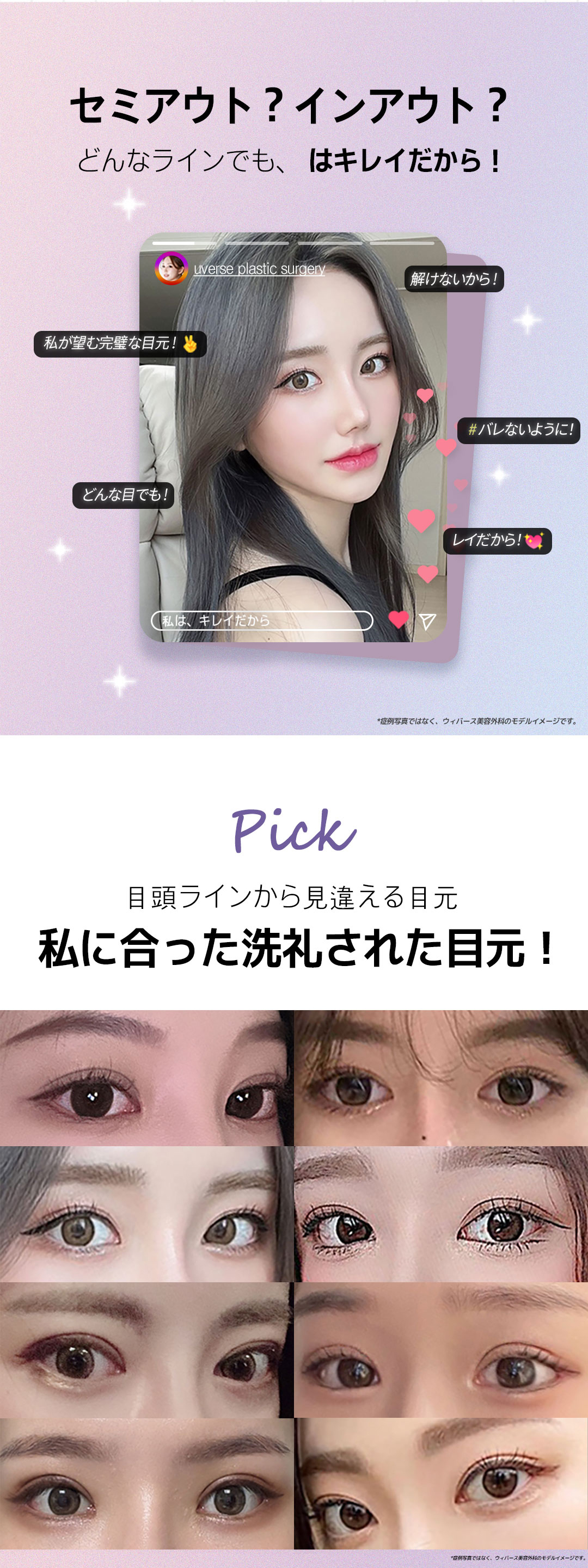 Weavers Thẩm mỹ Seoul Gangnam｜Hướng đến đường viền khó tuột với chỉnh hình mí đôi bám dính tự nhiên｜Phương pháp cố định chân bì