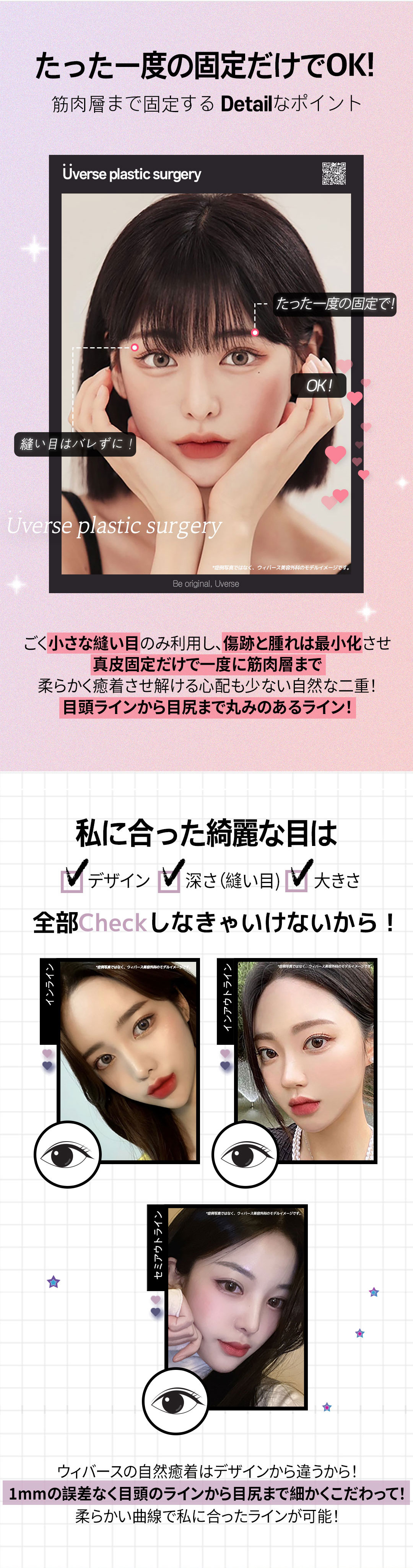 Weavers Thẩm mỹ Seoul Gangnam｜Hướng đến đường viền khó tuột với chỉnh hình mí đôi bám dính tự nhiên｜Phương pháp cố định chân bì