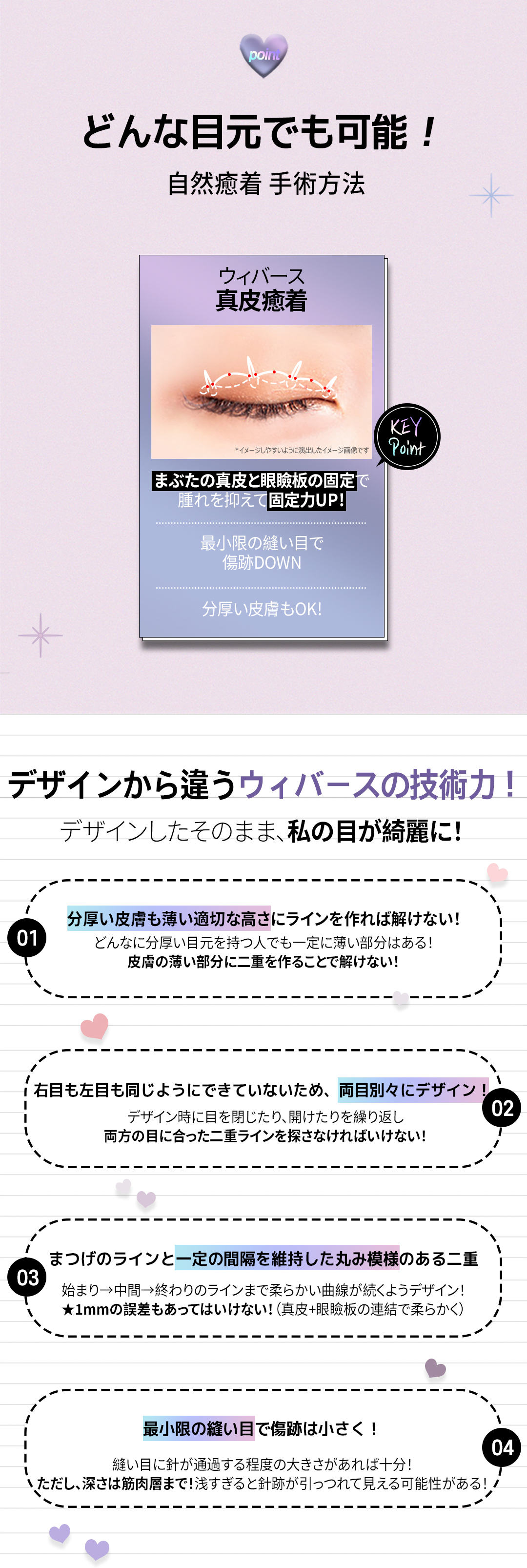 Weavers Thẩm mỹ Seoul Gangnam｜Hướng đến đường viền khó tuột với chỉnh hình mí đôi bám dính tự nhiên｜Phương pháp cố định chân bì