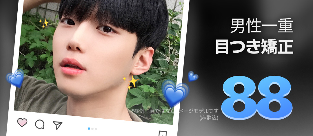 Chỉnh ánh mắt mí một nam Hàn Quốc | Thủ thuật không cắt hướng tới đôi mắt rõ ràng tự nhiên | Sharp Thẩm mỹ・Ga Sinnonhyeon Seoul