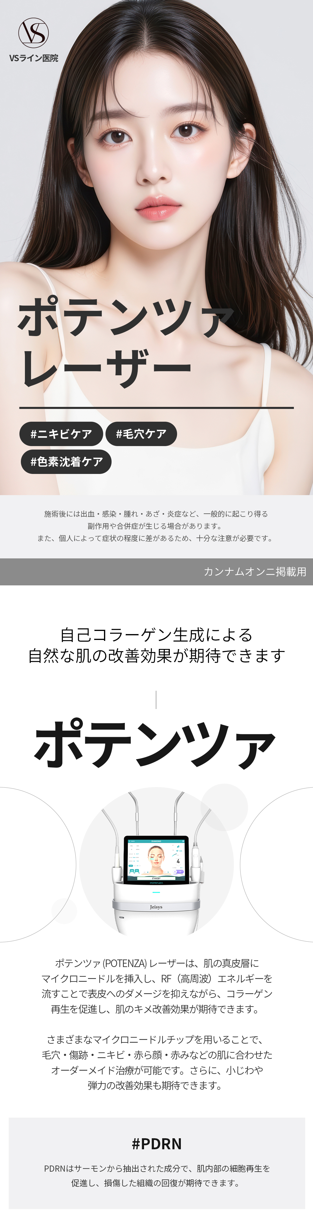 Chăm sóc lỗ chân lông・mụn bằng Potenza Laser | Điều trị Microneedle × RF