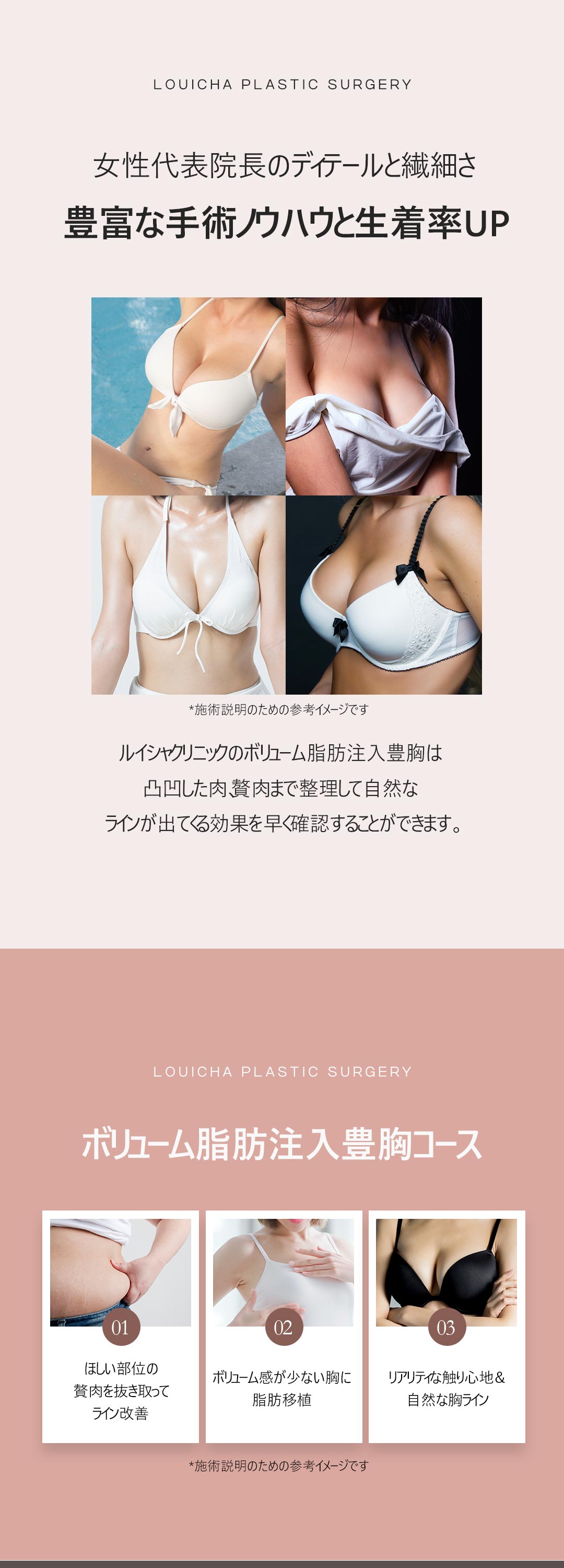 Nâng ngực tiêm mỡ tự thân | Liệu trình tinh tế bởi bác sĩ trưởng nữ hướng đến đường ngực tự nhiên | Louise Clinic Gangnam Seoul