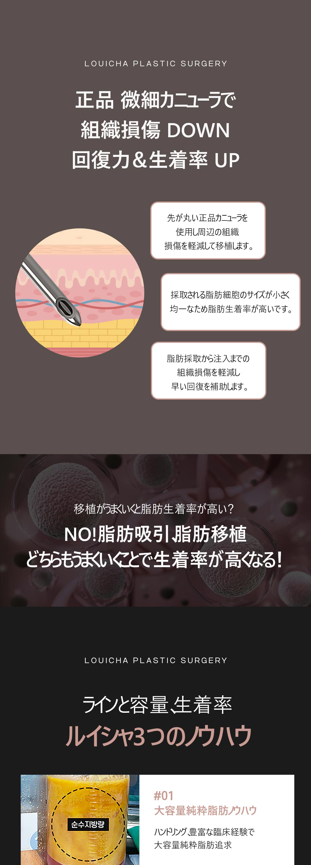 Nâng ngực tiêm mỡ tự thân | Liệu trình tinh tế bởi bác sĩ trưởng nữ hướng đến đường ngực tự nhiên | Louise Clinic Gangnam Seoul