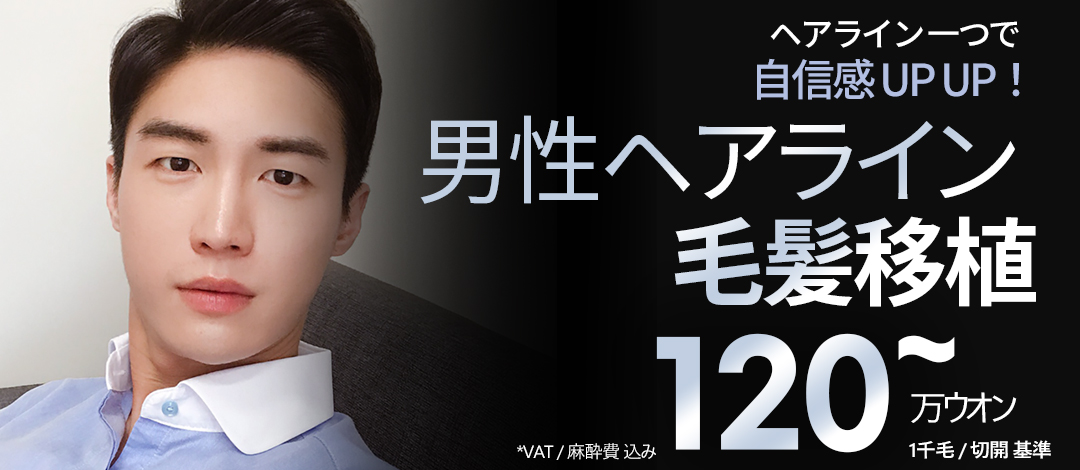 Phẫu thuật cấy tóc Hàn Quốc | Hướng đến tăng tự tin với cải thiện đường chân tóc nam | OK Phòng khám ga Cheongdam quận Gangnam