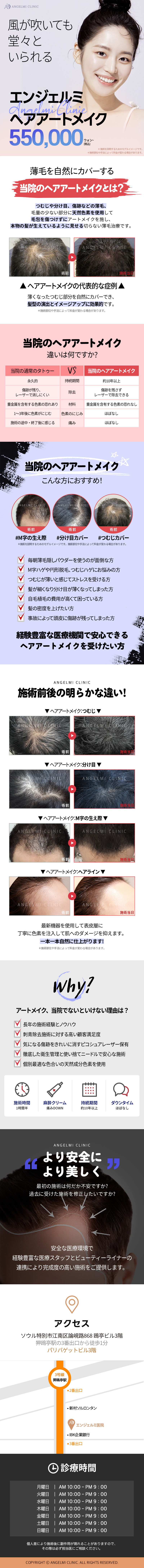 Phun xăm tóc tại Angelmi Clinic | Liệu pháp che phủ tự nhiên vùng tóc thưa