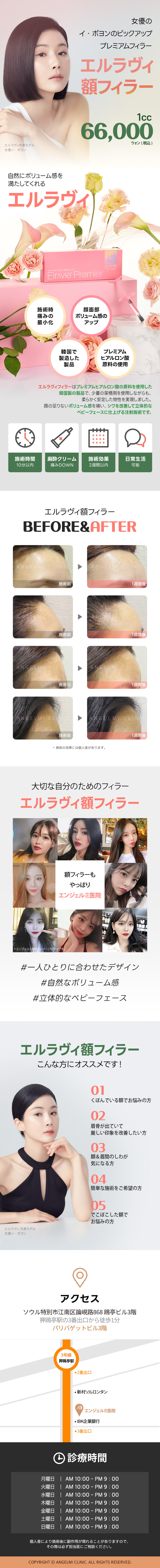 Filler trán Elravie | Hướng đến cảm giác volume tự nhiên với hyaluronic acid cao cấp | Angel Mi Phòng khám Apgujeong