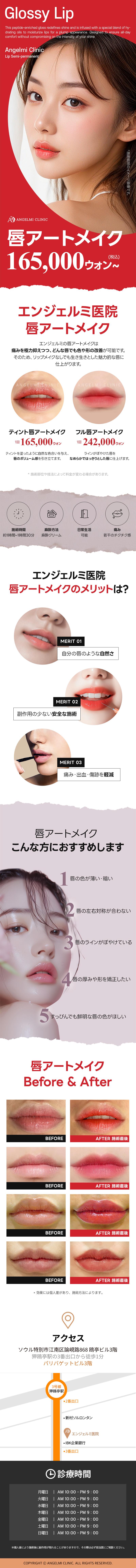 Phun xăm môi tại Angel Mi Clinic Apgujeong Hàn Quốc | Thủ thuật nhằm phát màu và hình dạng tự nhiên | Thiết kế giảm đau