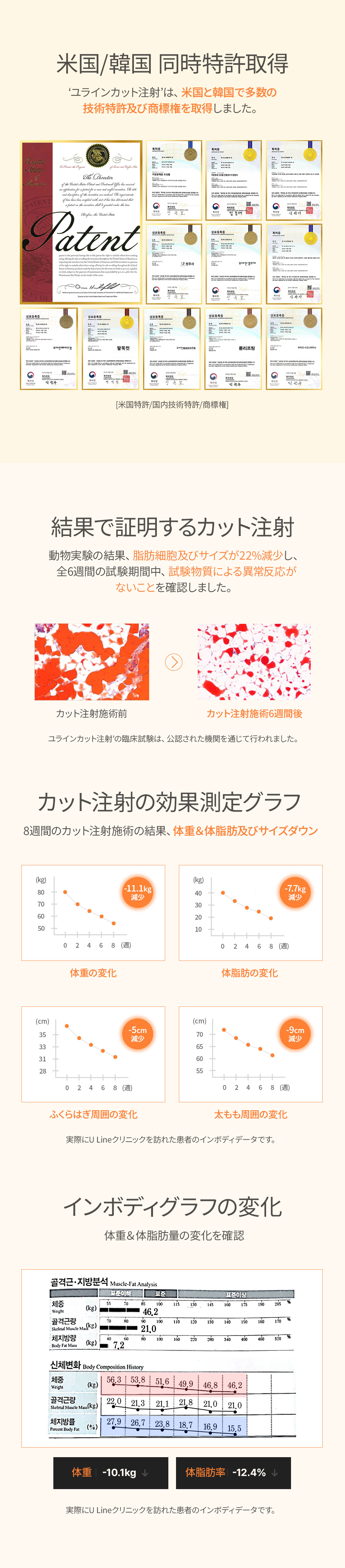 Tiêm Tune & Cut | Giảm béo y tế phá hủy tế bào mỡ + cải thiện đường cong cơ thể | U-Line Clinic Gangnam Seoul