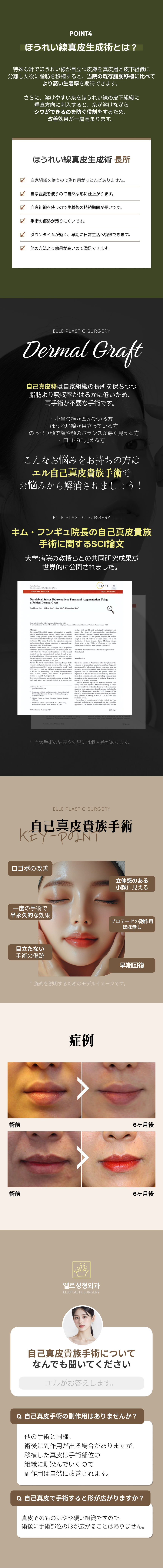 Cải thiện rãnh mũi môi tự nhiên bằng cấy ghép da tự thân | Phẫu thuật quý tộc - Thành tích luận văn SCI | L Thẩm mỹ Ngoại khoa