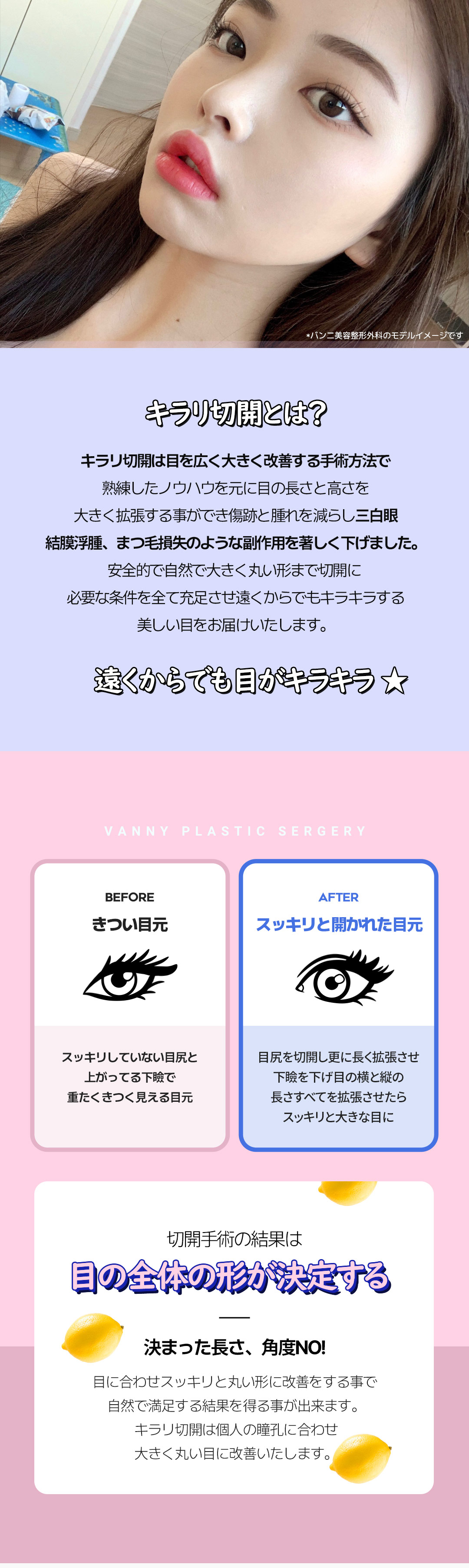 Cắt đuôi mắt Kirari | Mở rộng chiều ngang・chiều dọc mắt tự nhiên | Banni Thẩm mỹ cách ga Gangnam 1 phút đi bộ