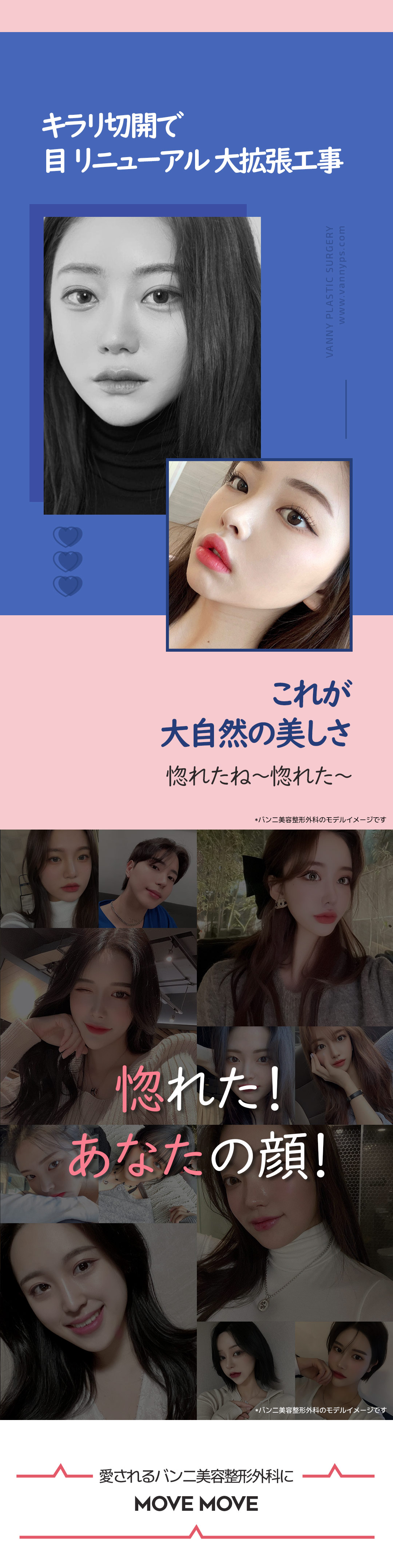 Cắt đuôi mắt Kirari | Mở rộng chiều ngang・chiều dọc mắt tự nhiên | Banni Thẩm mỹ cách ga Gangnam 1 phút đi bộ