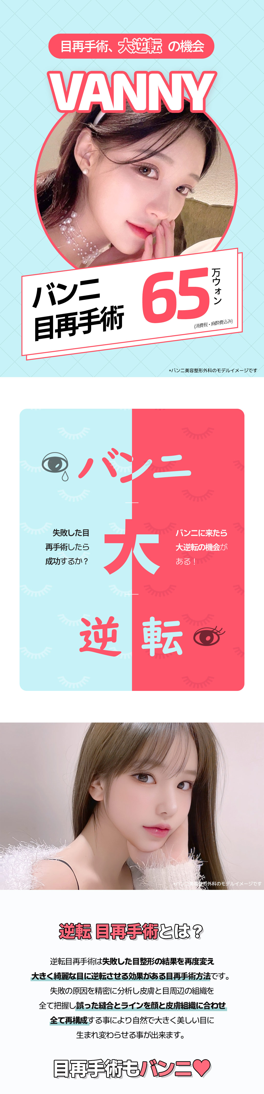 Hướng đến kết quả tự nhiên với phẫu thuật lại mắt｜Banni Thẩm mỹ Gangnam Hàn Quốc｜650.000 won (khoảng 70.000 yên)