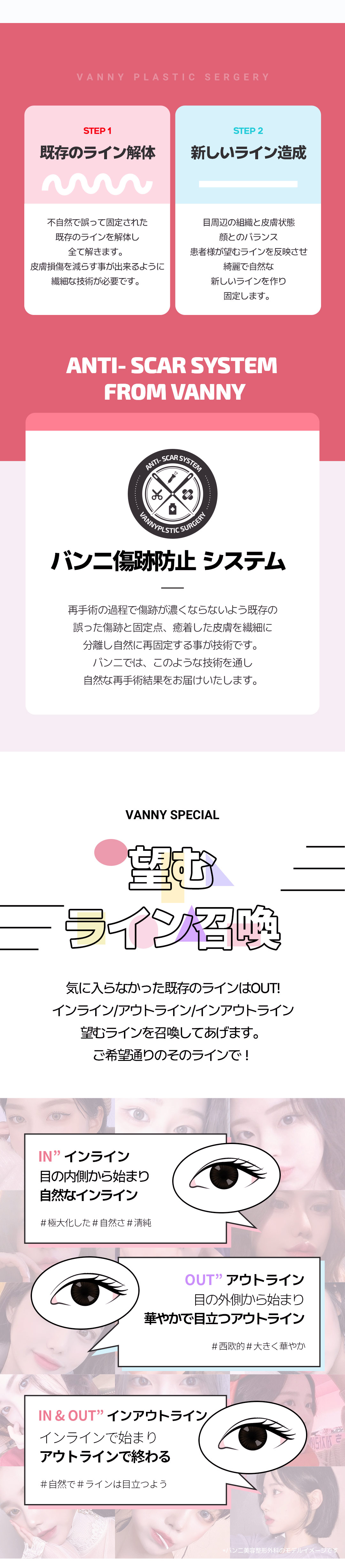 Hướng đến kết quả tự nhiên với phẫu thuật lại mắt｜Banni Thẩm mỹ Gangnam Hàn Quốc｜650.000 won (khoảng 70.000 yên)