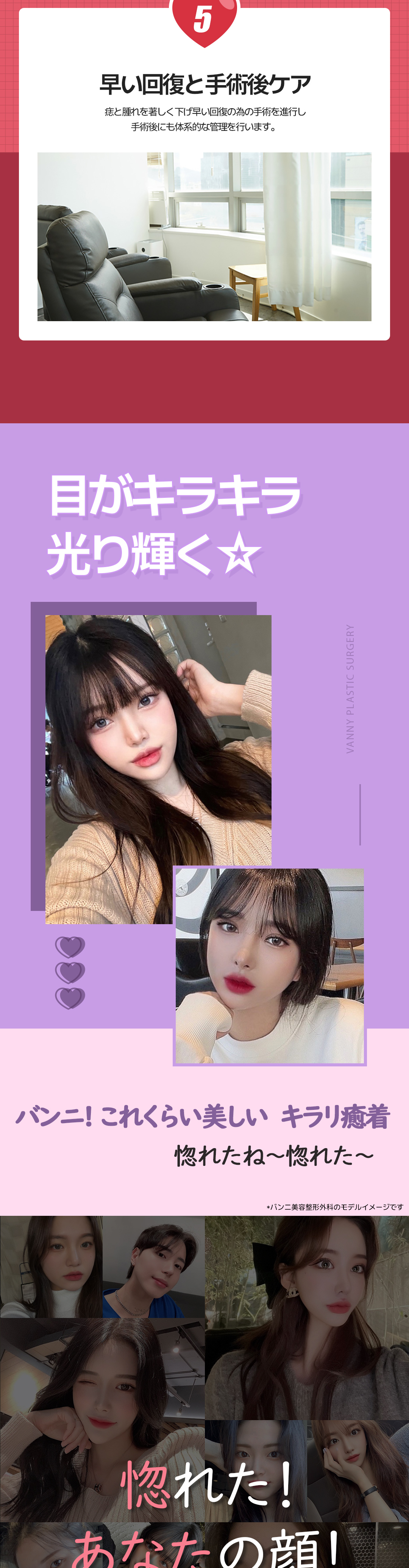 Hướng tới đôi mắt tự nhiên với Phương pháp dính Kirari mí đôi | Bấm mí khó tuột và sẹo khó thấy | Banni Thẩm mỹ・Cách ga Gangnam 1 phút đi bộ