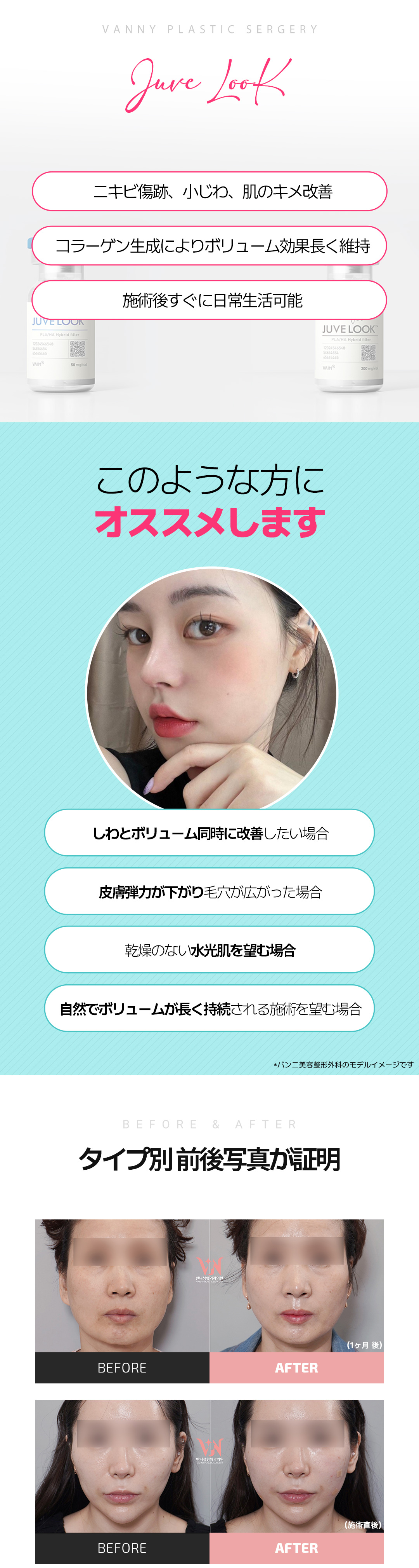 Banni Juvelook & Juvelook Volume