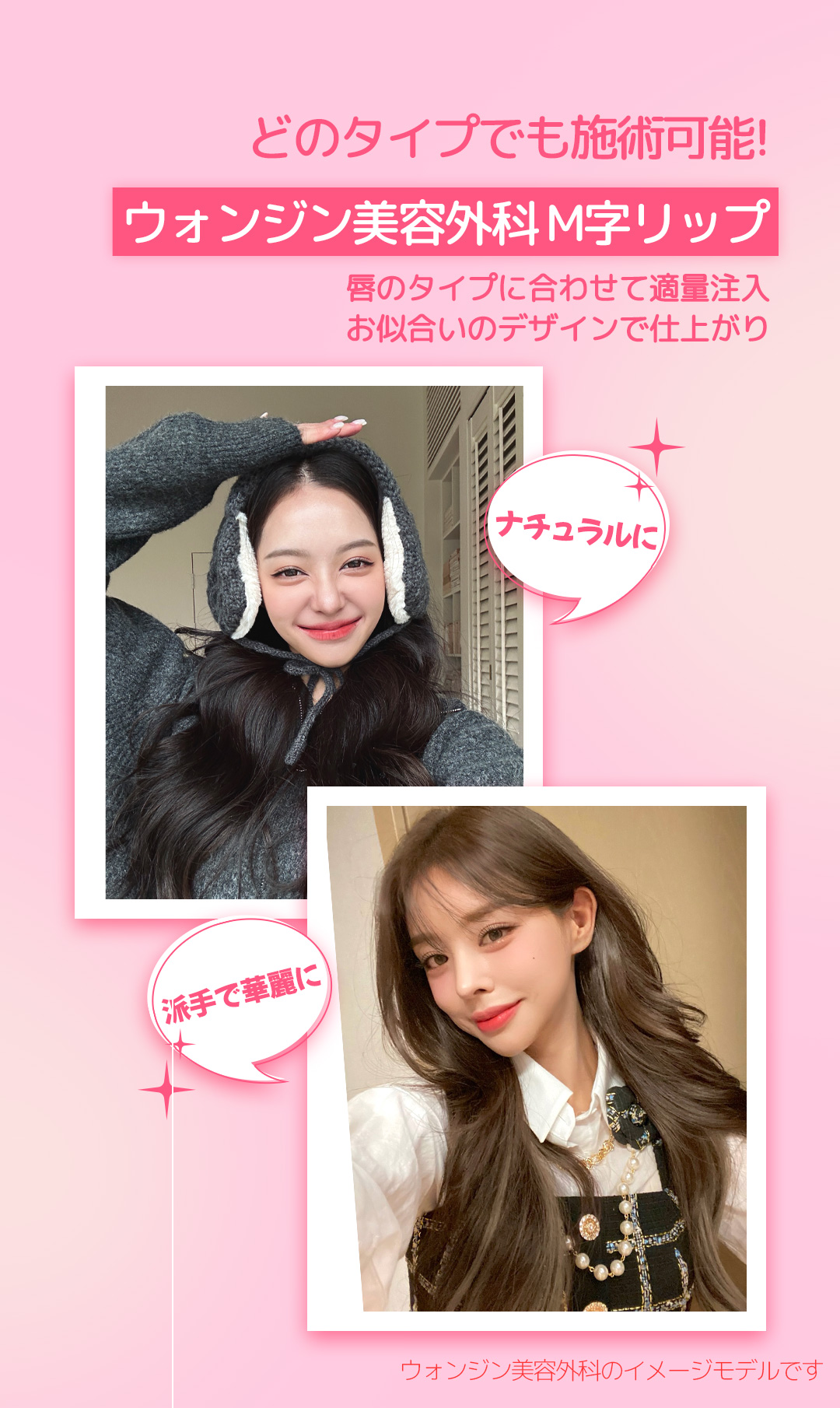 Bộ filler môi chữ M + Botox khóe miệng｜Thủ thuật hướng đến môi đáng yêu｜Phẫu thuật Thẩm mỹ WJ Wonjin ga Gangnam 3 phút