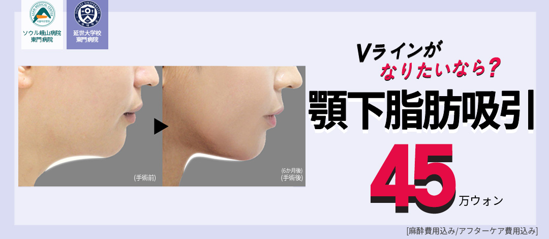 Hút mỡ dưới cằm tại Phòng khám Thẩm mỹ Jerim Hàn Quốc hướng đến tạo hình V-line | 30 năm kinh nghiệm trước ga Apgujeong