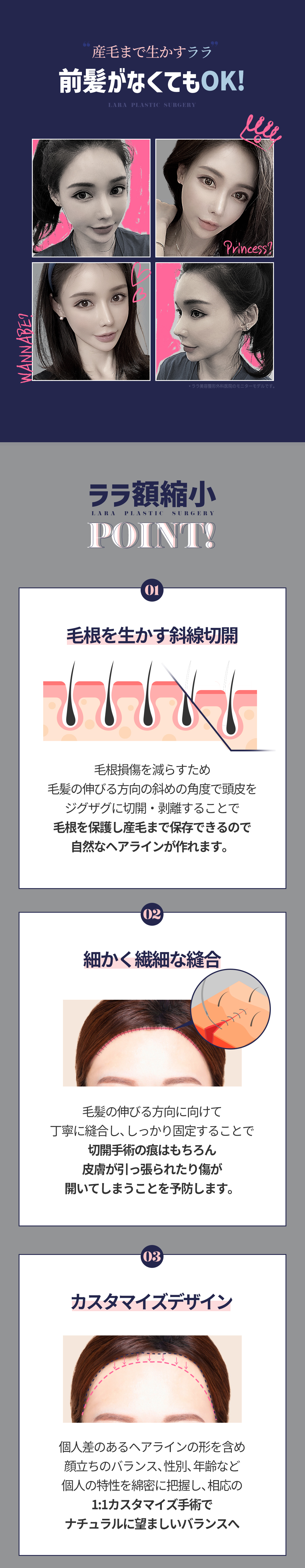 Hướng đến cân đối khuôn mặt lý tưởng với phẫu thuật thu nhỏ trán｜Lala Thẩm mỹ Phẫu thuật Tạo hình không gọt xương・bảo vệ chân tóc