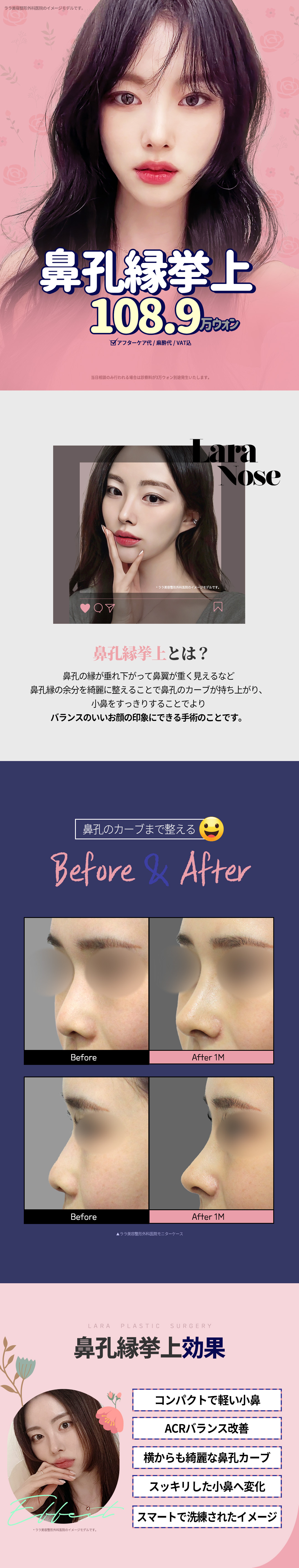 Hướng tới cải thiện ấn tượng cánh mũi bằng nâng viền cánh mũi | Chỉnh sửa gọn gàng viền cánh mũi sệ | Seoul Gangnam Lala Phẫu thuật Tạo hình Thẩm mỹ