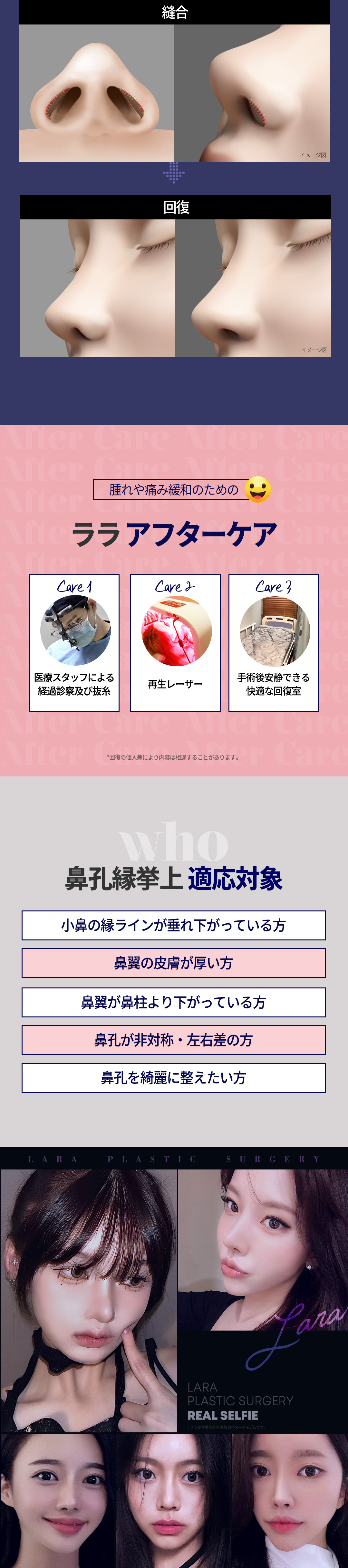 Hướng tới cải thiện ấn tượng cánh mũi bằng nâng viền cánh mũi | Chỉnh sửa gọn gàng viền cánh mũi sệ | Seoul Gangnam Lala Phẫu thuật Tạo hình Thẩm mỹ