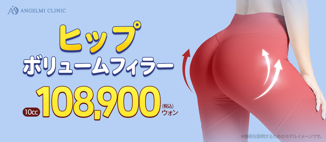 Filler tăng độ căng mông｜Tiêm Hyaluronic Acid không cần rạch hướng đến nâng mông｜Phòng khám Angel Mi Apgujeong