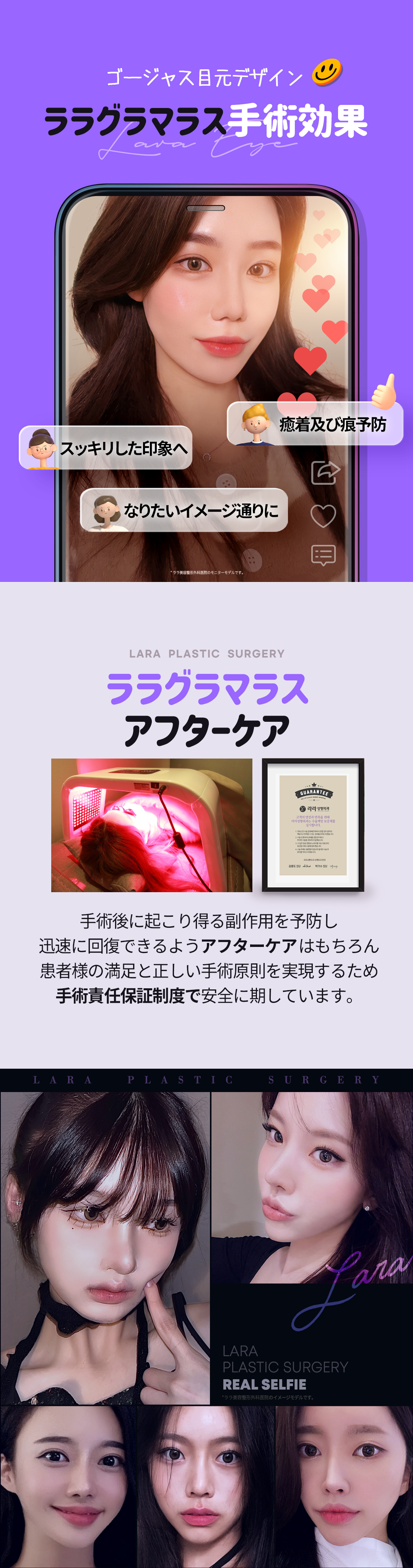 Hướng tới cải thiện mắt tự nhiên với Tạo mắt cụp Glamorous | Seoul Gangnam stn.・Lala Thẩm mỹ Phòng khám【Thẩm mỹ Hàn Quốc】