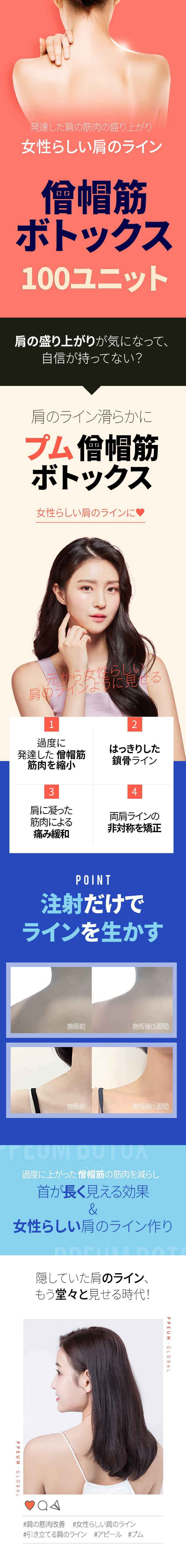 Botox cơ thang 100 unit hướng đến cải thiện đường vai｜Phòng khám Pum Global Myeongdong