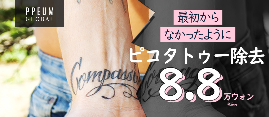 Xóa hình xăm bằng Pico Laser | Đặc điểm và giá của Phòng khám Pum Global Myeong-dong