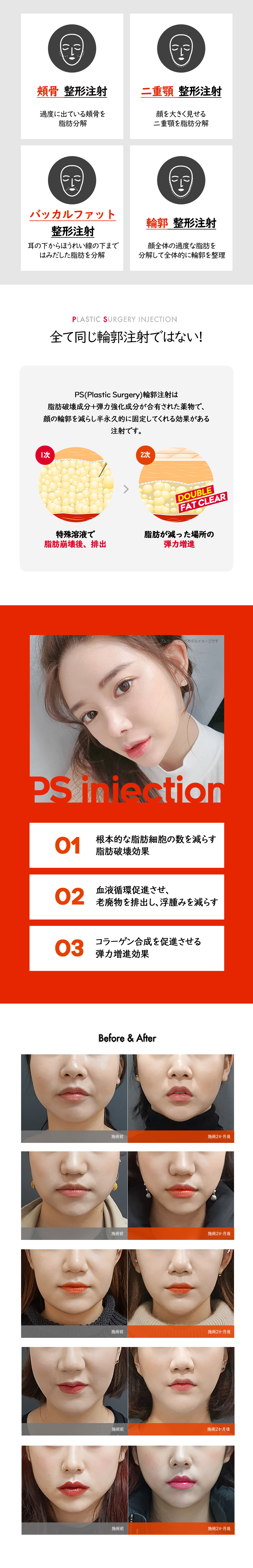 Tiêm đường viền PS 3cc chăm sóc khuôn mặt V-line｜Phương pháp 2 bước phân giải mỡ × tăng cường độ đàn hồi｜Pum Global Myeongdong