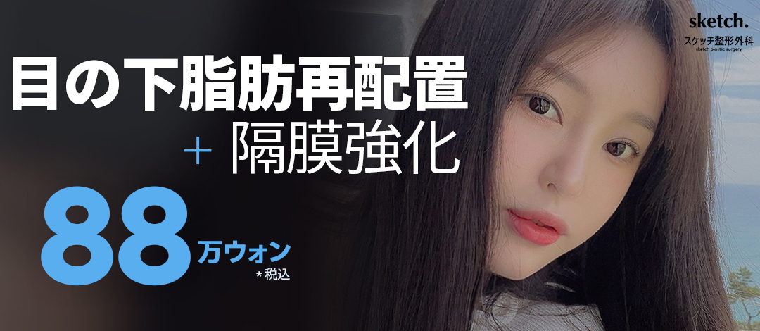 Tái phân bổ mỡ dưới mắt + củng cố vách ngăn｜Thủ thuật cải thiện quầng thâm và chảy xệ｜Gangnam Sketch Plastic Surgery