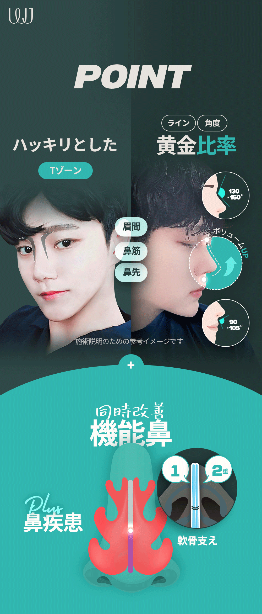 【Nâng mũi nam giới】Nâng mũi Hàn Quốc hướng tới kết hợp chức năng và vẻ đẹp | WJ Wonjin Phẫu thuật Thẩm mỹ Gangnam