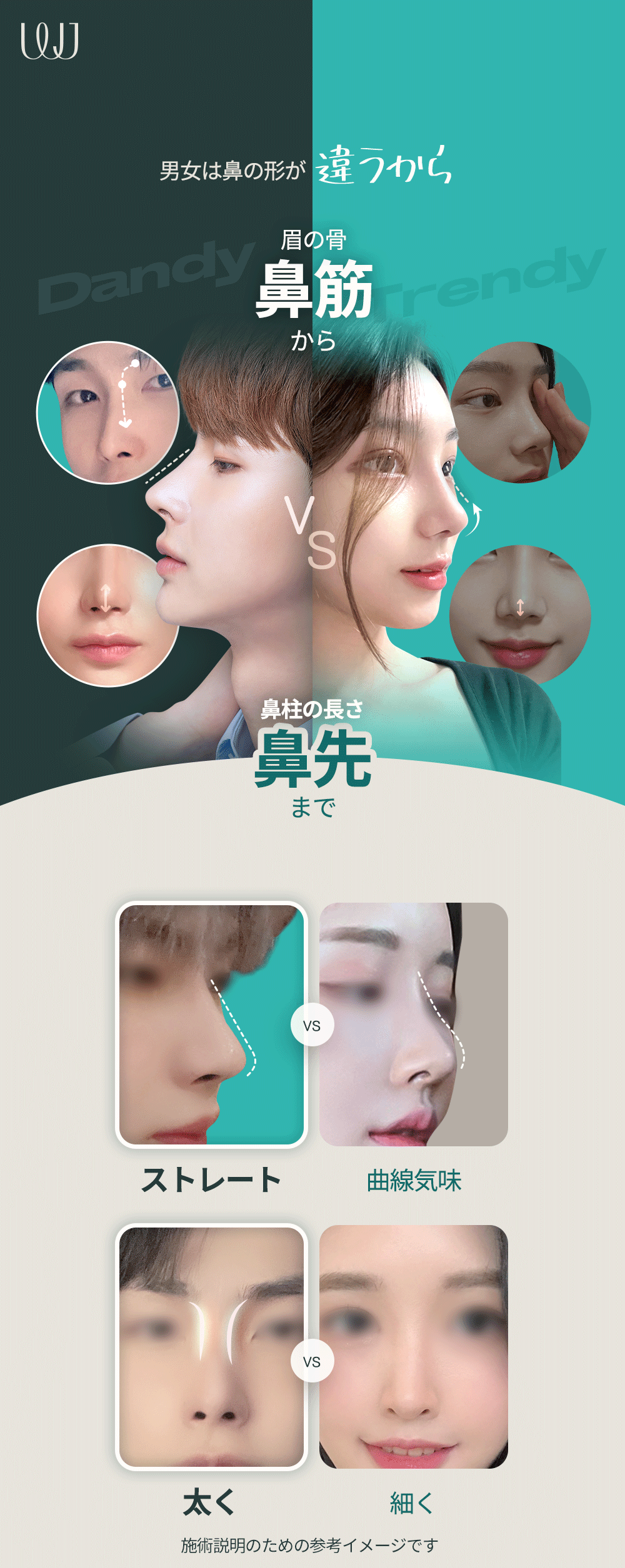 【Nâng mũi nam giới】Nâng mũi Hàn Quốc hướng tới kết hợp chức năng và vẻ đẹp | WJ Wonjin Phẫu thuật Thẩm mỹ Gangnam