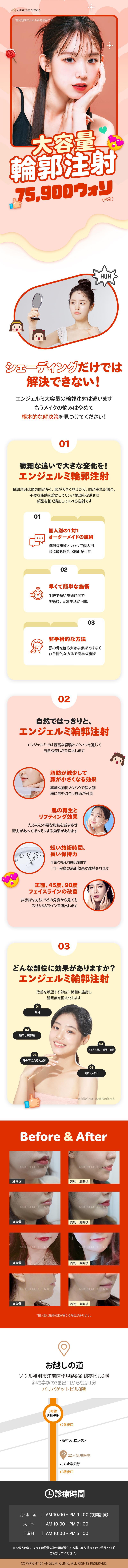 Tiêm tạo đường viền Hàn Quốc | Dung lượng lớn 75,900 Won | Phòng khám Angel Mi | Cách ga Apgujeong 1 phút