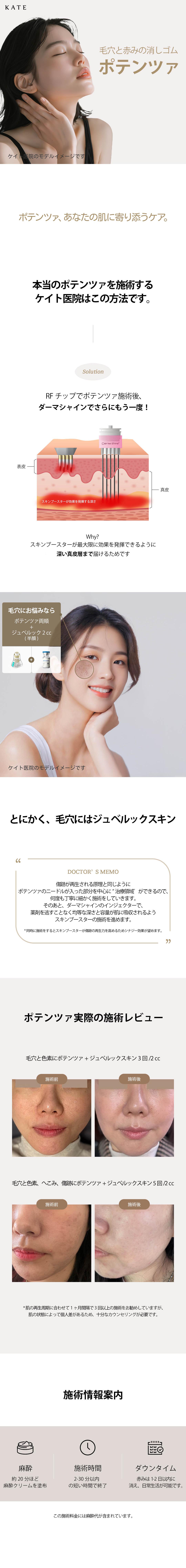Potenza + Juvelook chăm sóc lỗ chân lông và sẹo mụn | Tiếp cận từ lớp bì | Phòng khám Kate Hongdae