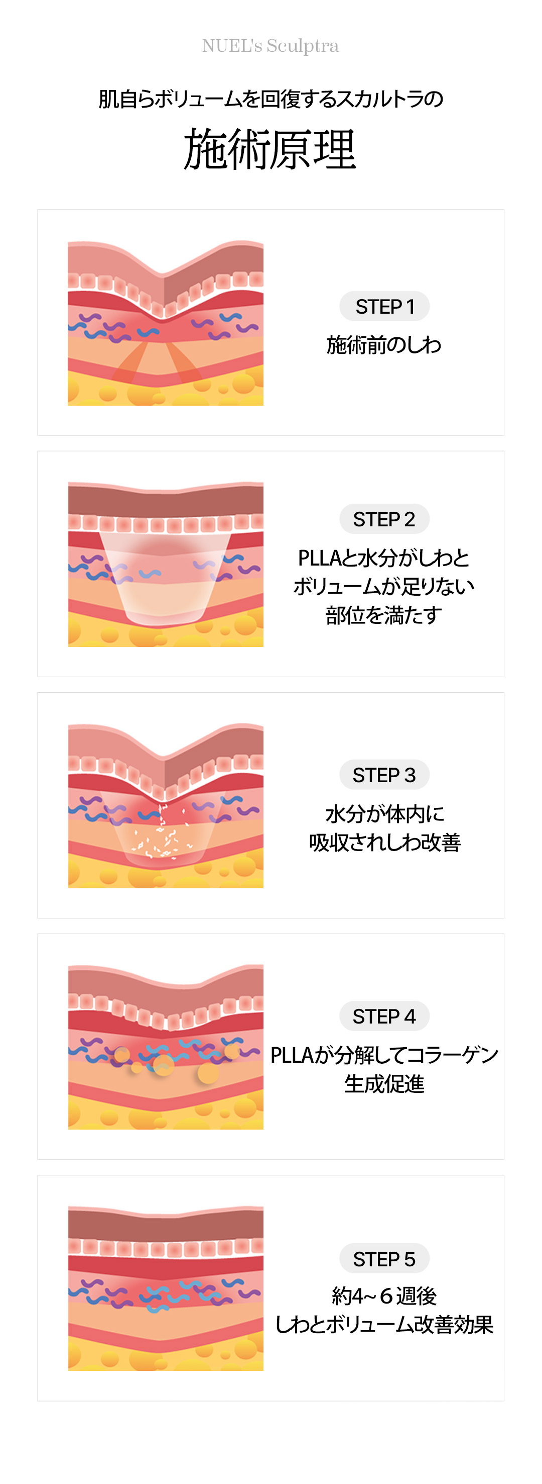 Tạo Collagen Sculptra Top 10 Newel