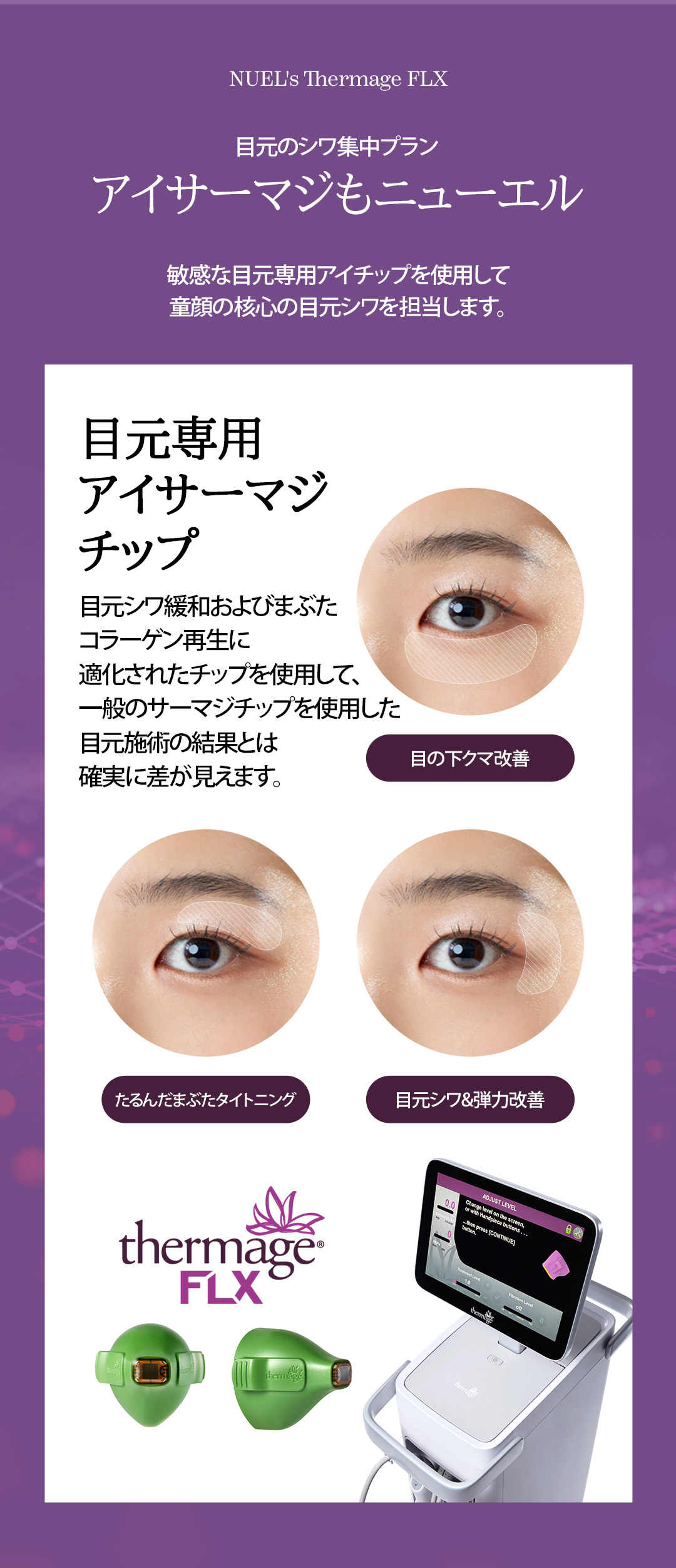 Thermage FLX 300 shot | Nâng cơ cao tần sử dụng đầu tip chính hãng | Phòng khám Newel | Seoul ga Sinsa