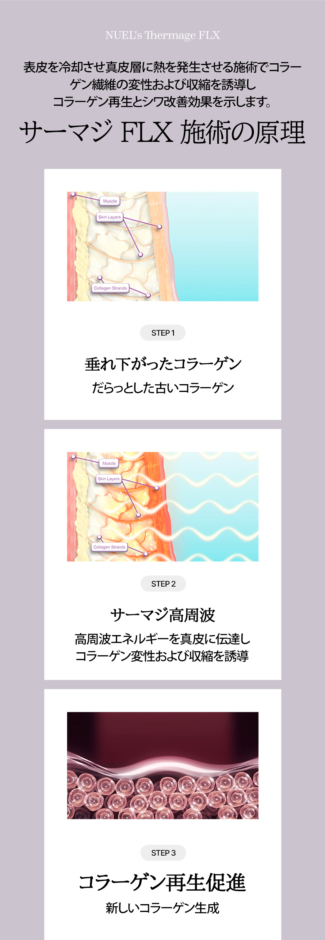 Thermage FLX 300 shot | Nâng cơ cao tần sử dụng đầu tip chính hãng | Phòng khám Newel | Seoul ga Sinsa