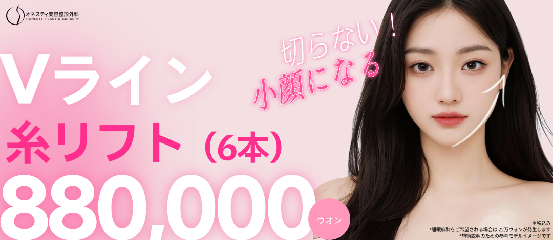 Chỉ nâng V-line 6 sợi tại Viện thẩm mỹ Honesty ga Sinsa Hàn Quốc｜Thủ thuật nâng cơ mặt nhỏ không dao